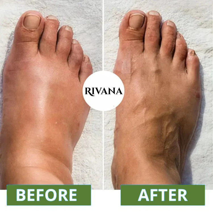 NMES Foot Massager